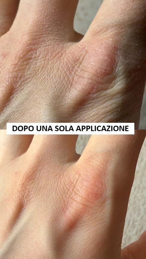 Salva-mani definitivo