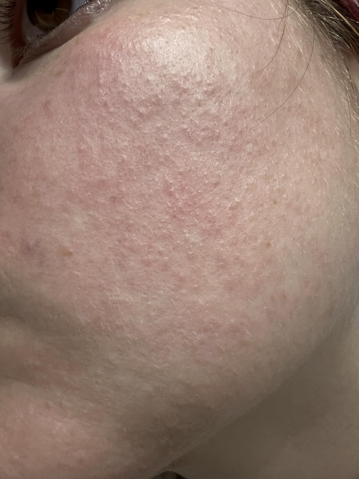 Finalmente una crema solare che non fa brillare